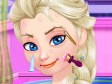 Ice Queen Acne Treatment